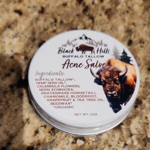Black Hills Buffalo Tallow Acne Salve